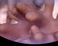 picture of Devil's Hand Leather Coral Med                                                                       Lobophytum pauciflorum